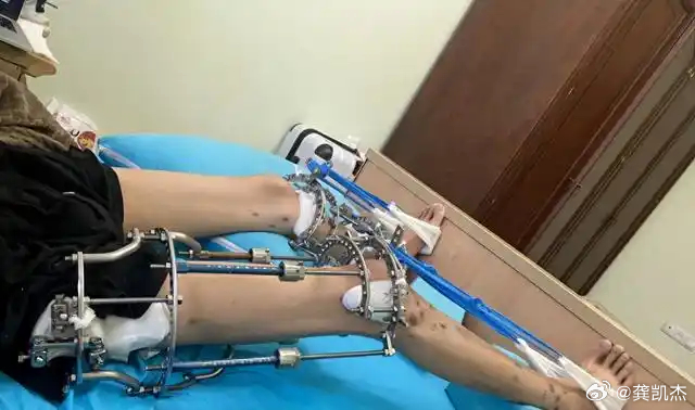 折骨头视频探究折骨头视频，一种独特的艺术展现方式
